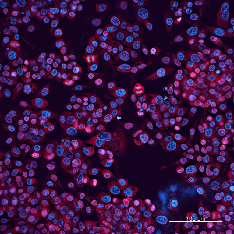 Ankyron APOA1_HUMAN Clone CI30539