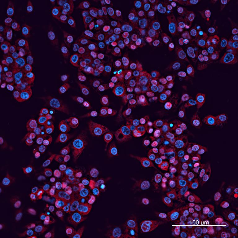 Ankyron APOA1_HUMAN Clone CI30548