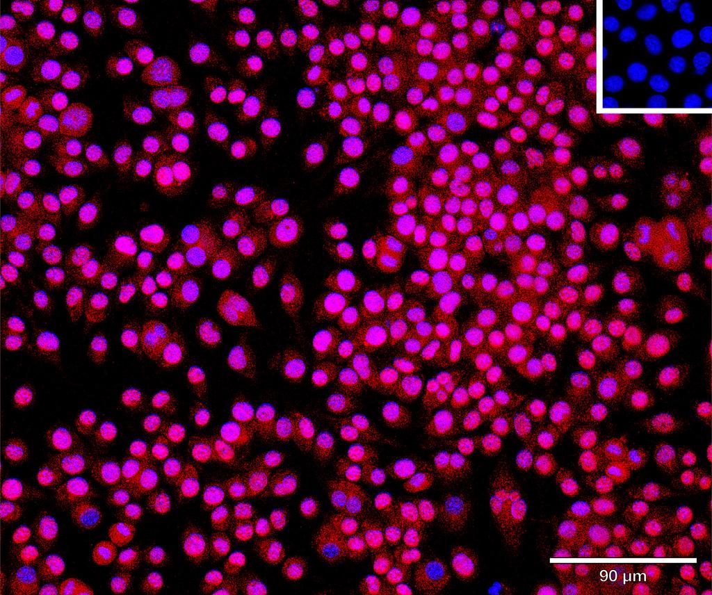 Ankyron APOA1_MOUSE Clone CU30623