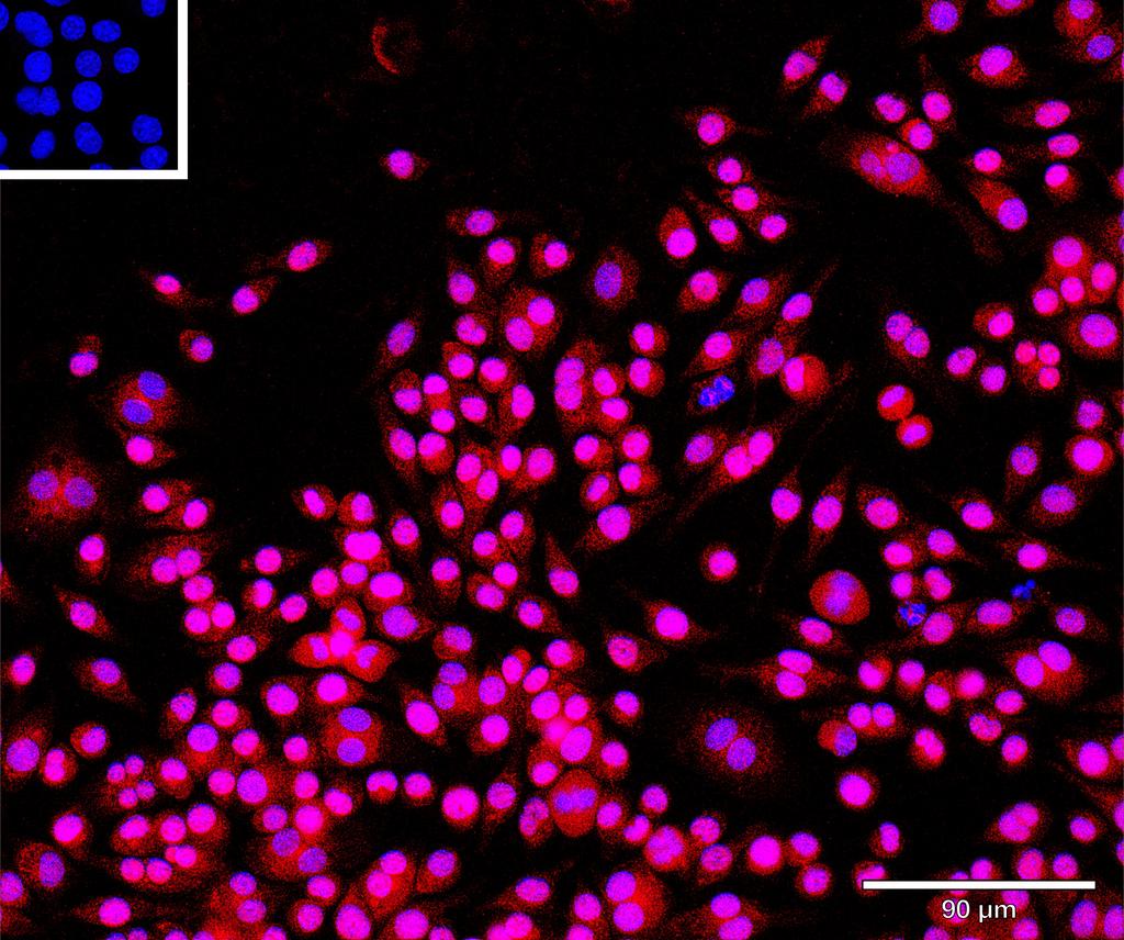 Ankyron APOA1_MOUSE Clone CU30625