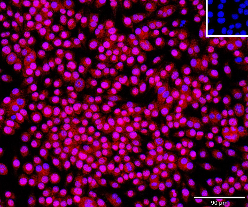 Ankyron APOA1_MOUSE Clone CU30635