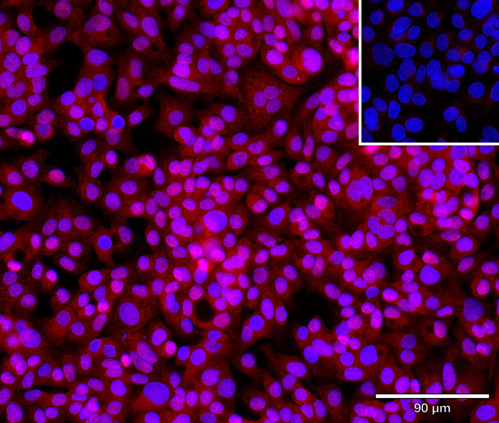 Ankyron APOA4_HUMAN Clone BK30165