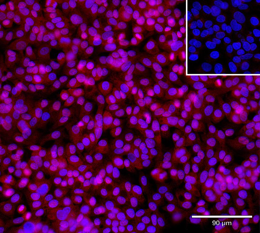 Ankyron APOA4_HUMAN Clone BK30163
