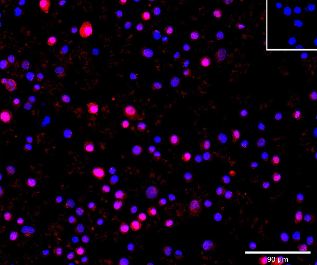 Ankyron APOA_HUMAN Clone BP40166