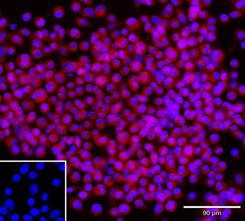 Ankyron AR2BP_HUMAN Clone CU31075