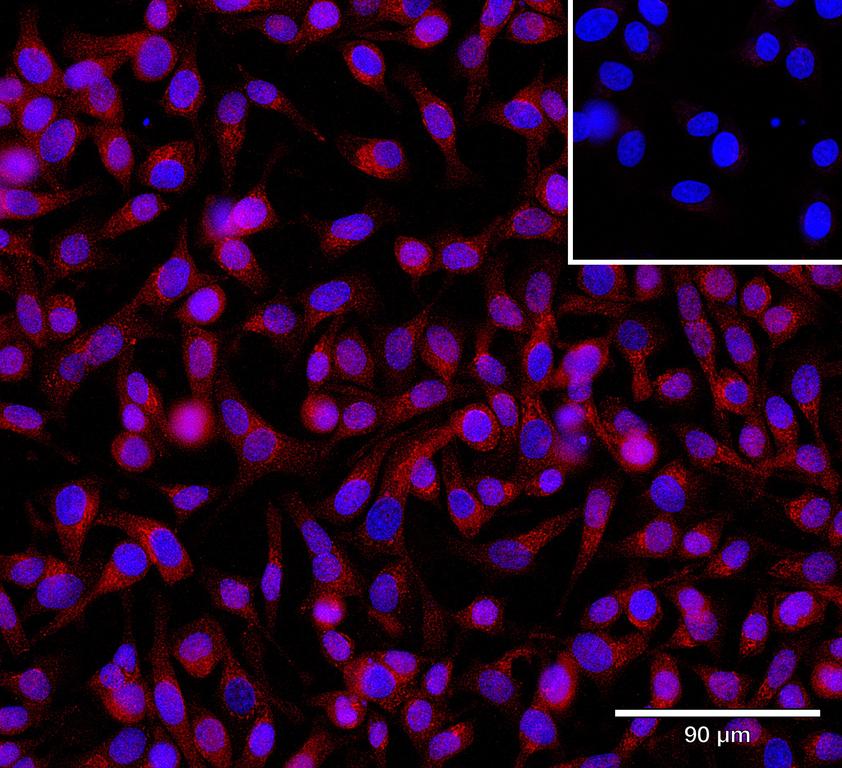 Ankyron AR2BP_HUMAN Clone CU31066