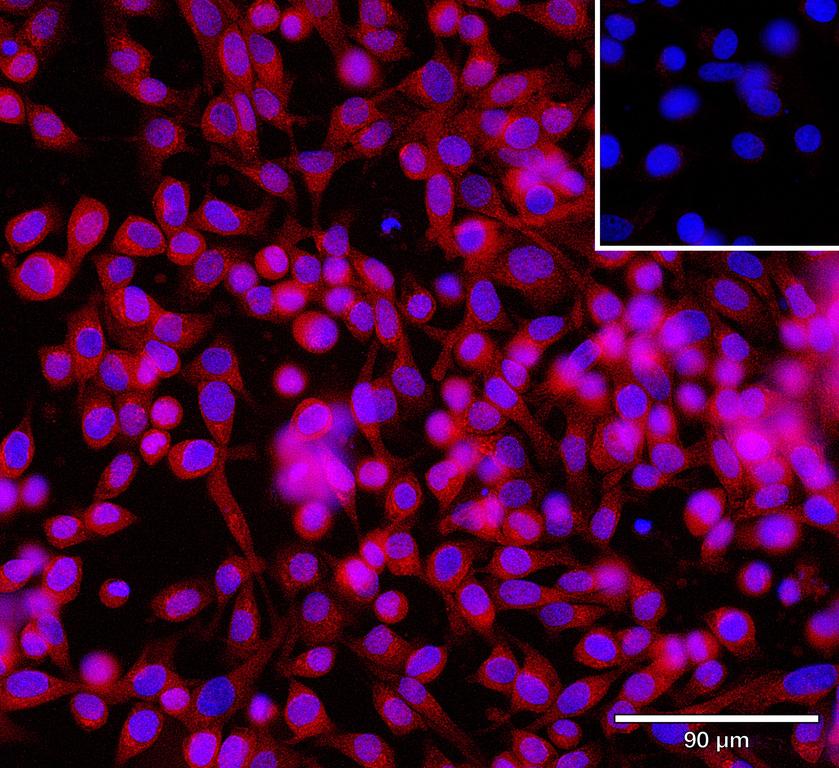 Ankyron AR2BP_HUMAN Clone CU31070