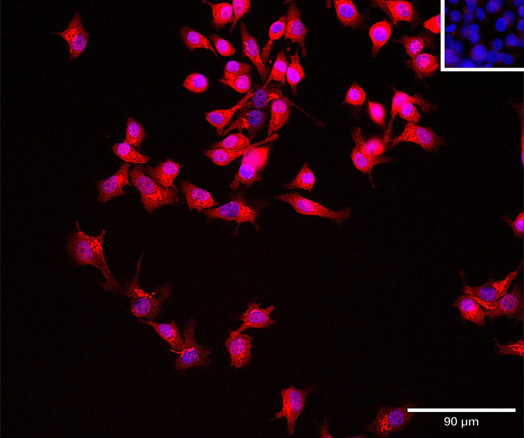 Ankyron ARP3_HUMAN Clone CU30609