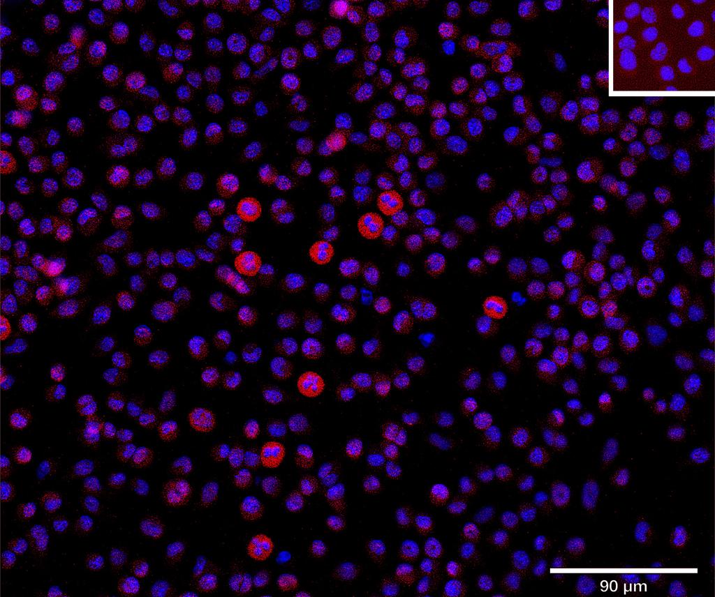 Ankyron ASAH2_MOUSE Clone CU31032