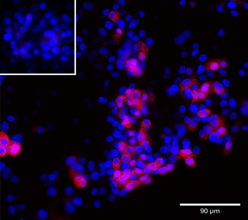 Ankyron ASGR1_HUMAN Clone BJ40247