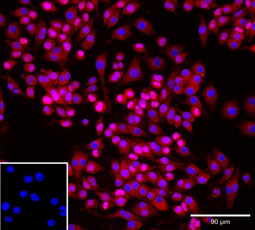 Ankyron ASGR1_MOUSE Clone AO40696