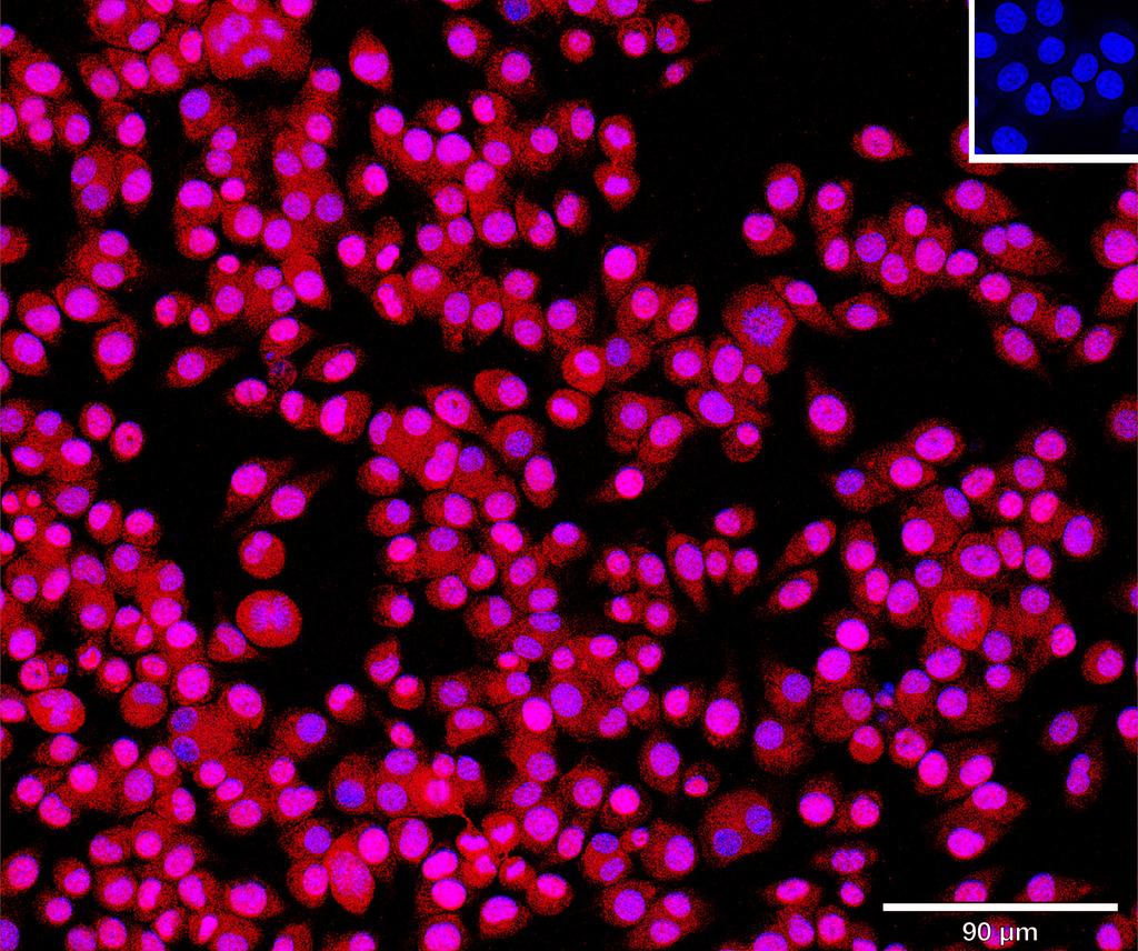 Ankyron ASM3A_MOUSE Clone DR40574