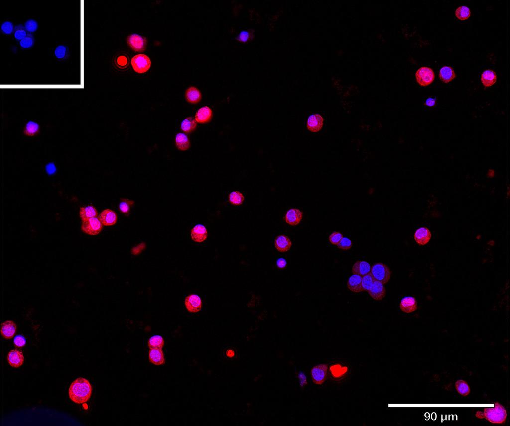 Ankyron ASPG_HUMAN Clone CU30362