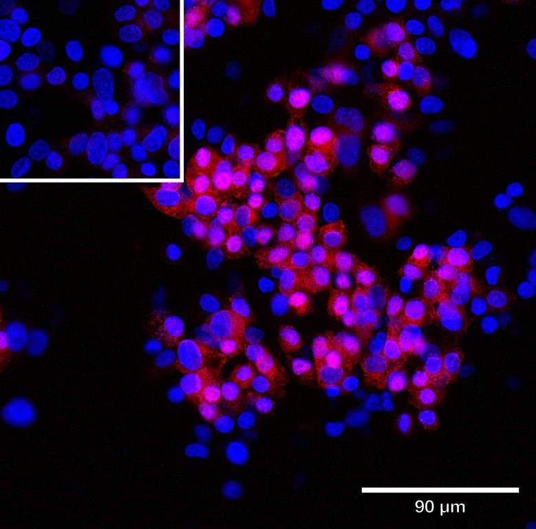 Ankyron AT1B2_HUMAN Clone CU30227