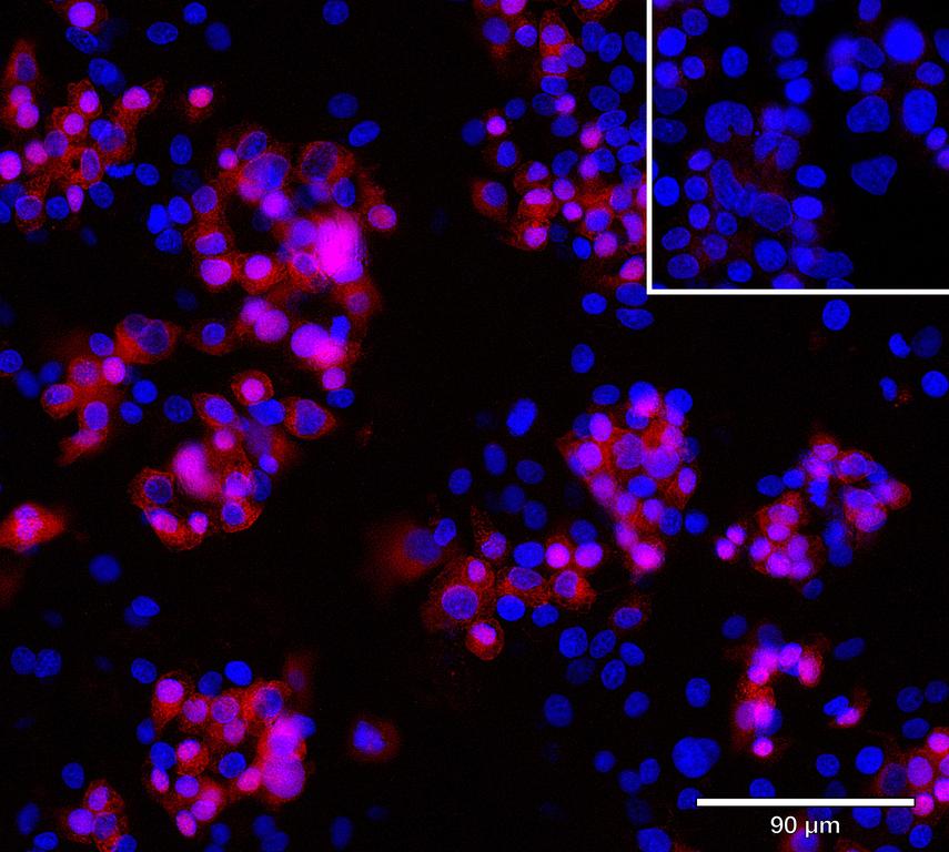 Ankyron AT1B2_HUMAN Clone CU30234