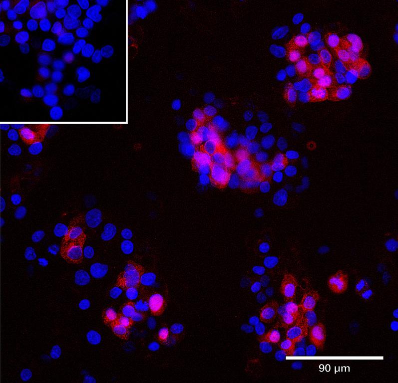 Ankyron AT1B2_HUMAN Clone CU30235