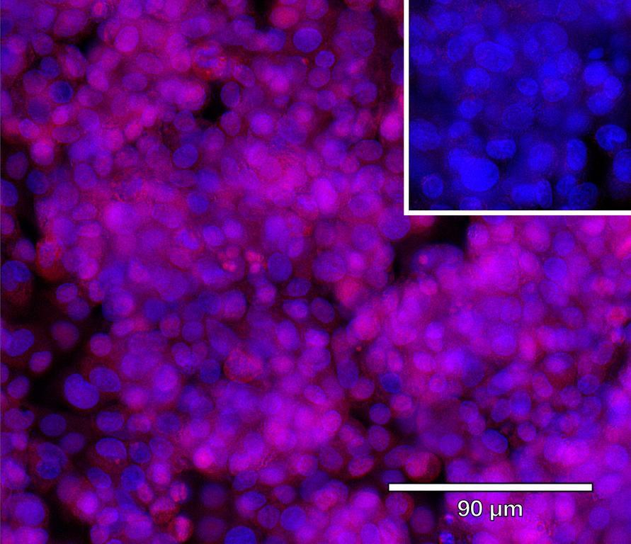 Ankyron AT1B2_HUMAN Clone CU30232