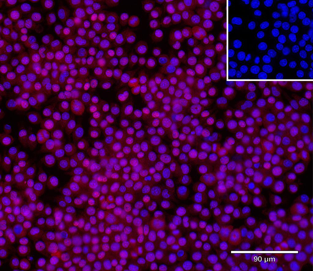 Ankyron B1AYH7_MOUSE Clone CY40590