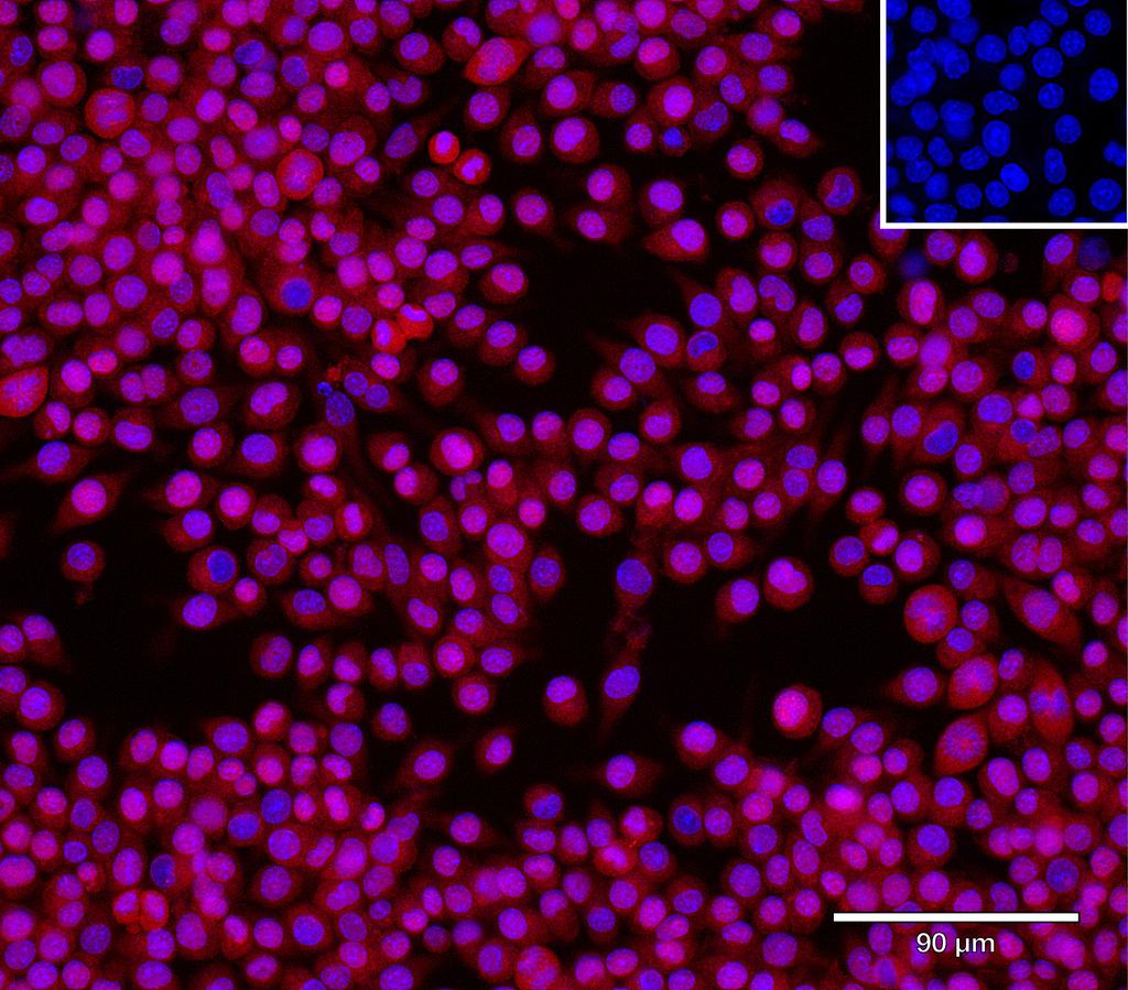 Ankyron B1AYH7_MOUSE Clone CY40586