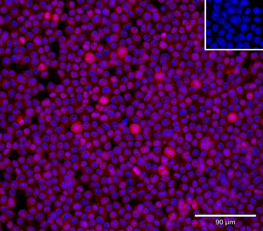 Ankyron B1AYH7_MOUSE Clone CY40589