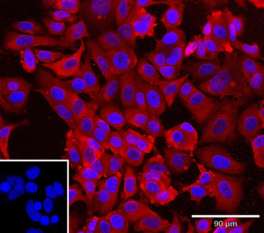 Ankyron B2CL1_HUMAN Clone BH40102