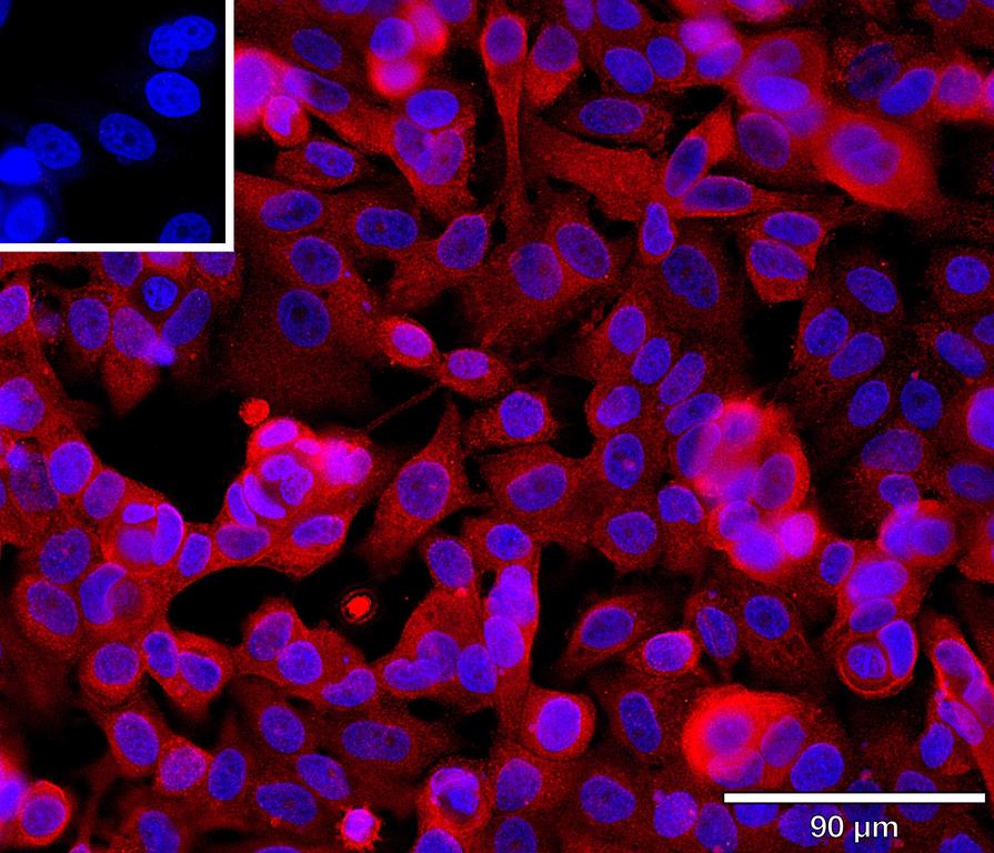Ankyron B2CL1_HUMAN Clone BA41105