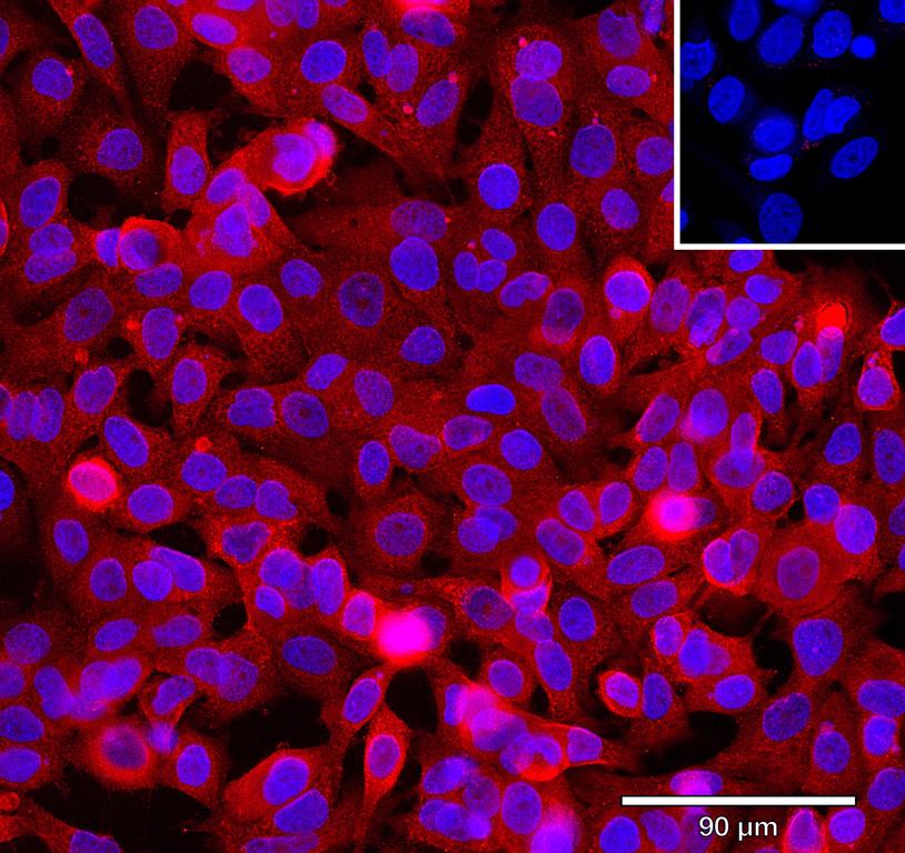 Ankyron B2CL1_HUMAN Clone BA41106