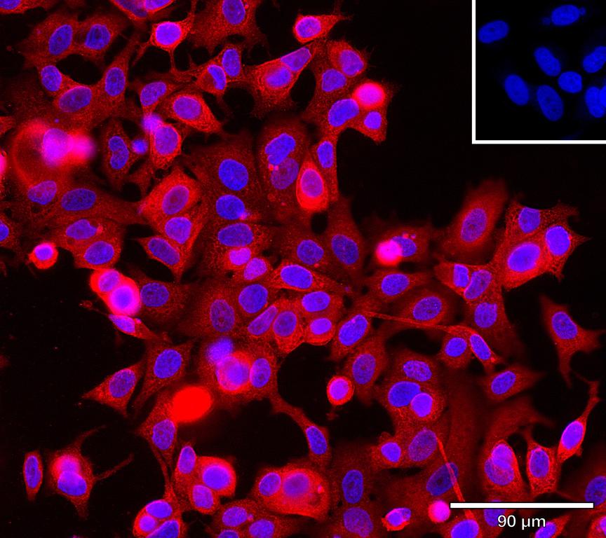 Ankyron B2CL1_HUMAN Clone BC40273