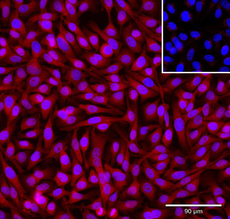 Ankyron B2CL1_HUMAN Clone AV40129
