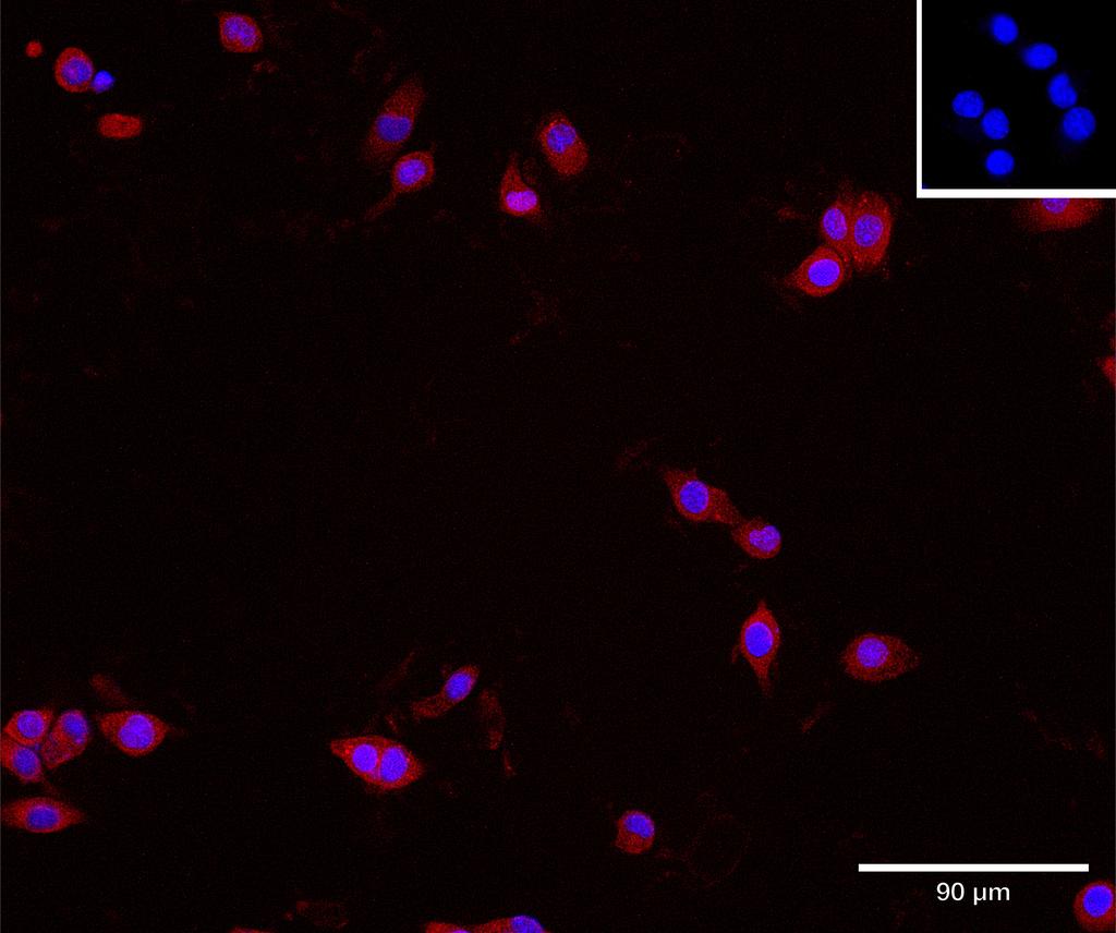 Ankyron B2CL1_MOUSE Clone AT40714