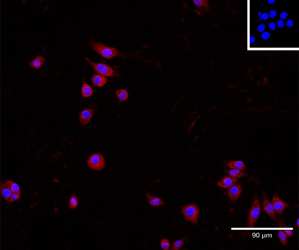 Ankyron B2CL1_MOUSE Clone AT40717