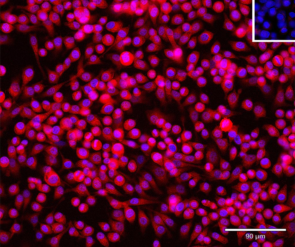 Ankyron B2CL2_HUMAN Clone CT30991