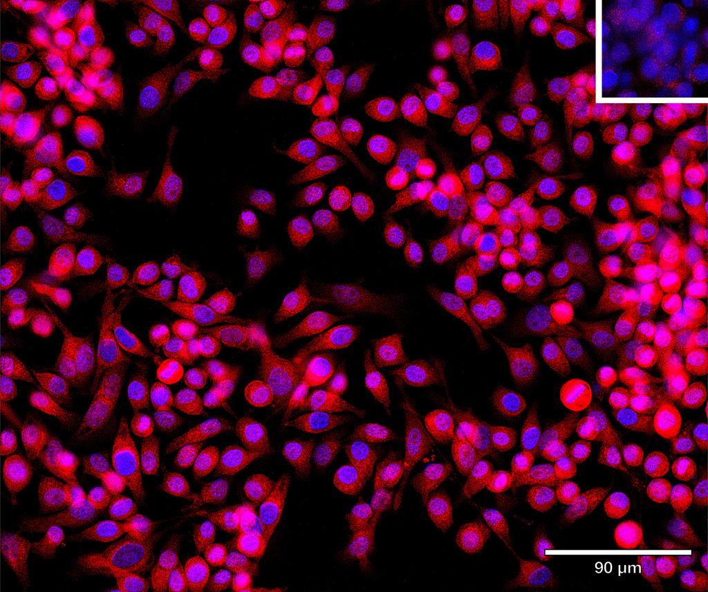 Ankyron B2CL2_HUMAN Clone CT30992