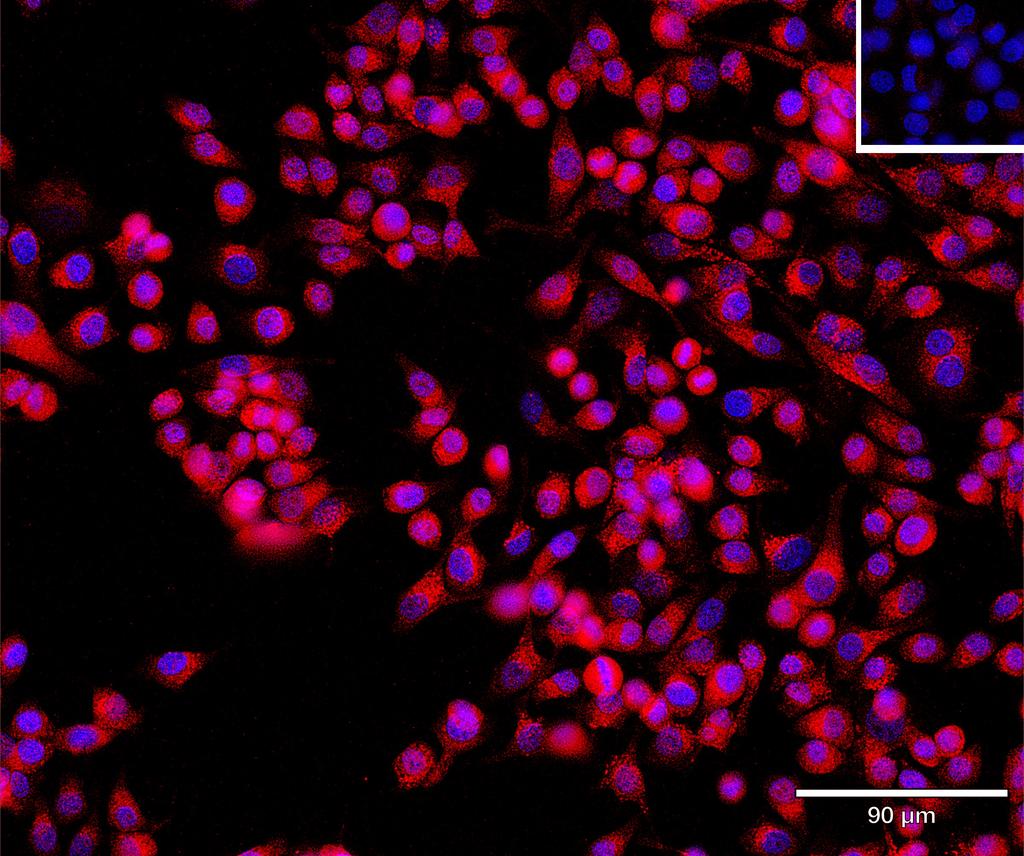 Ankyron B2CL2_HUMAN Clone CT30994