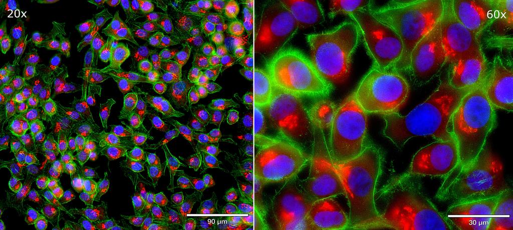 Ankyron B4GT1_HUMAN Clone CU30295