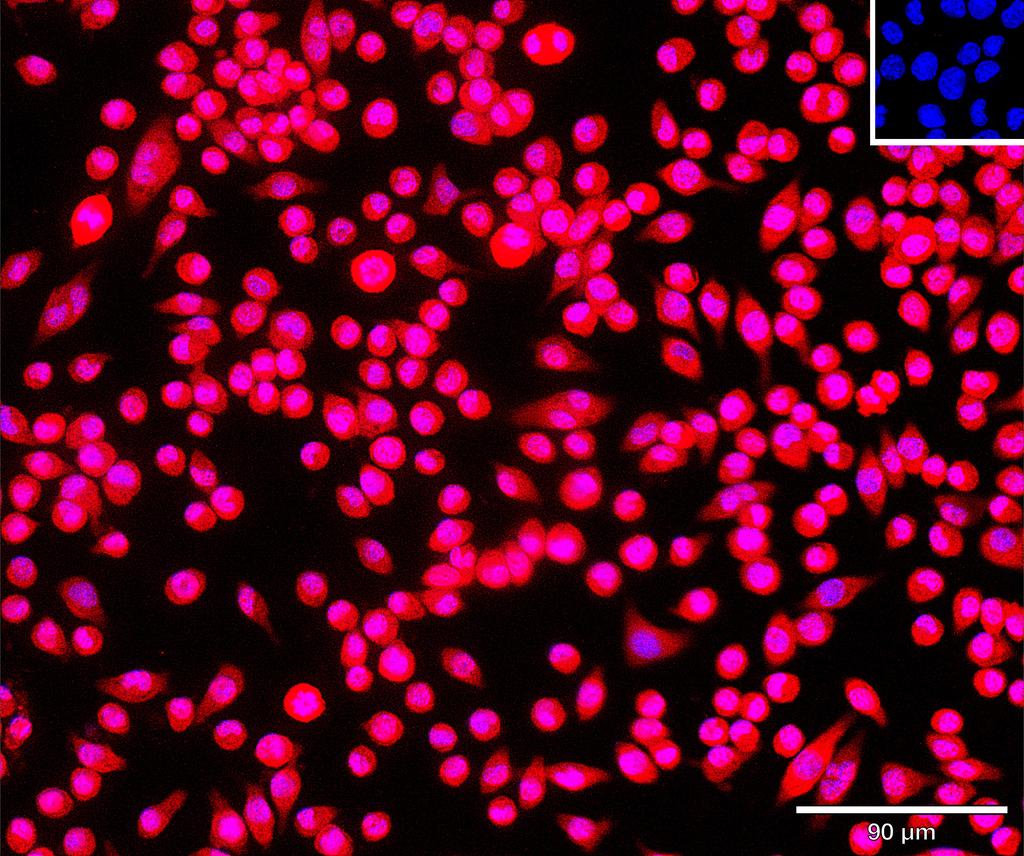 Ankyron B4GT1_MOUSE Clone CU30345