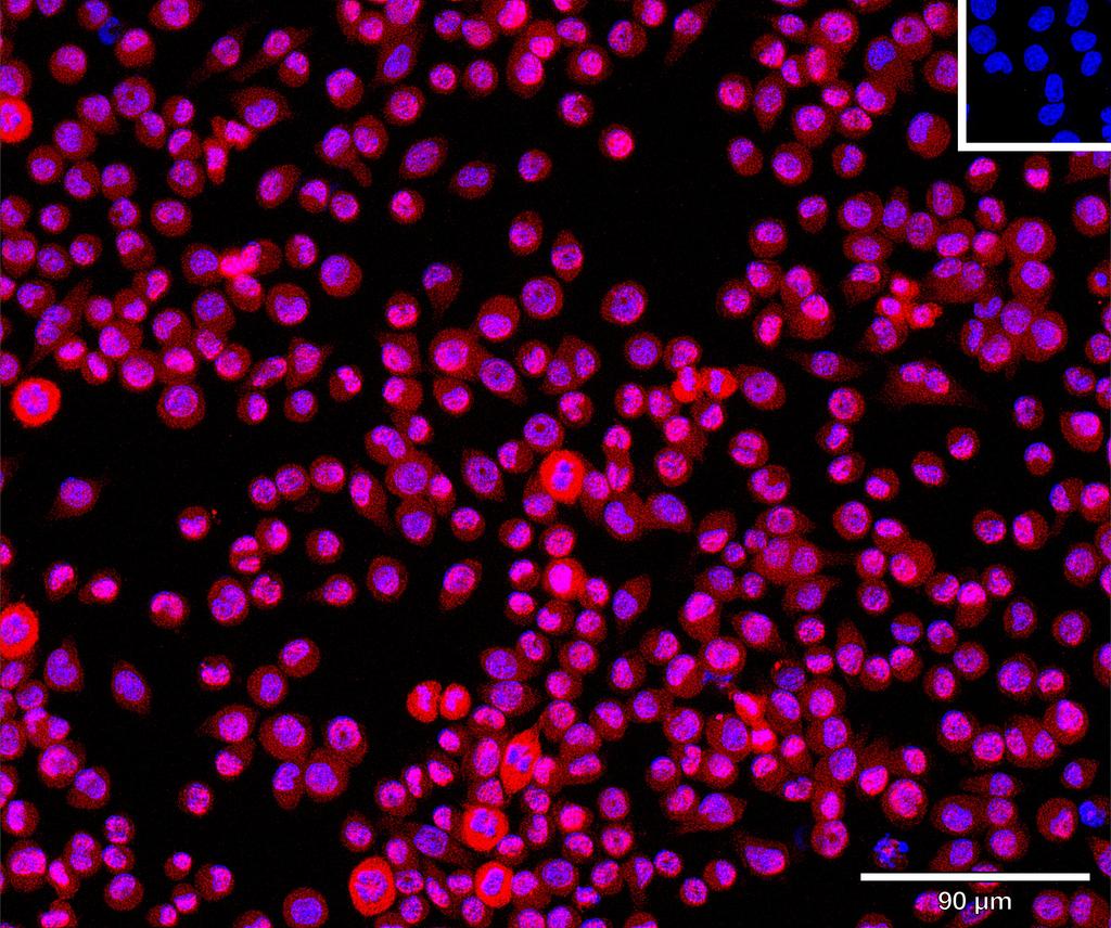 Ankyron B4GT1_MOUSE Clone CU30338