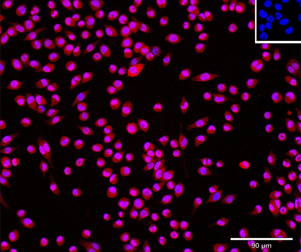 Ankyron B4GT1_MOUSE Clone CU30333