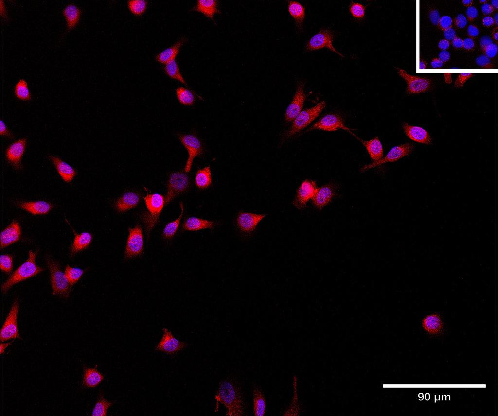 Ankyron BCCIP_HUMAN Clone CT31107