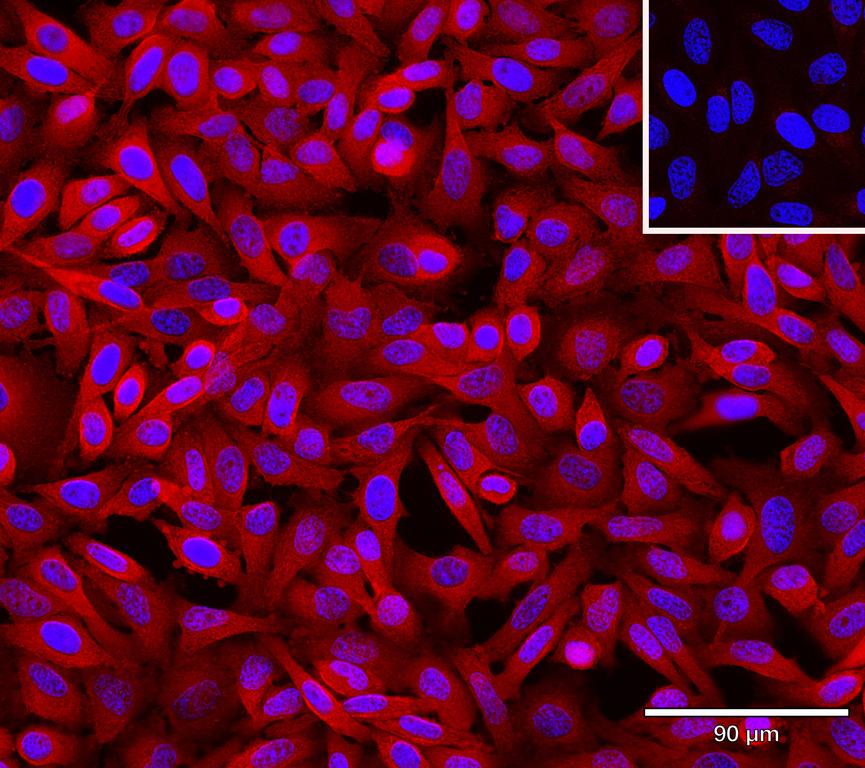 Ankyron BCL2_HUMAN Clone BZ30465