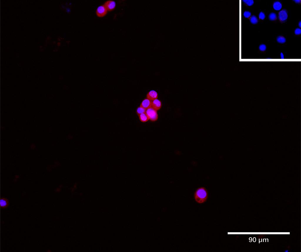 Ankyron BL1S2_HUMAN Clone BN30135