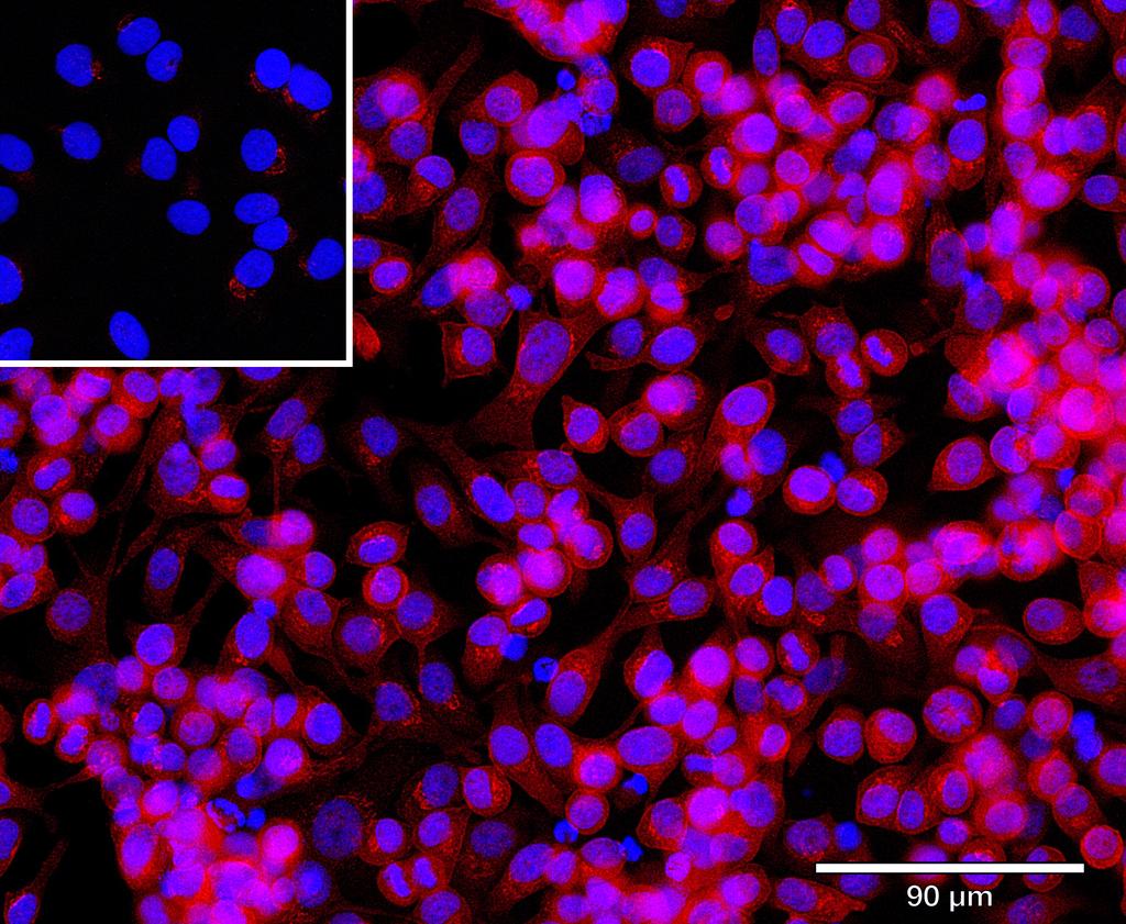 Ankyron BNI3L_HUMAN Clone CT30405