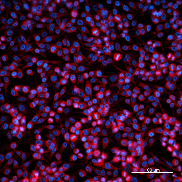 Ankyron CADH4_HUMAN Clone DV40428