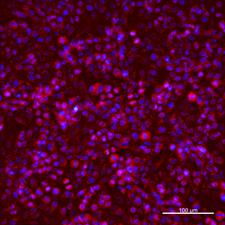 Ankyron CADH4_HUMAN Clone DV40432