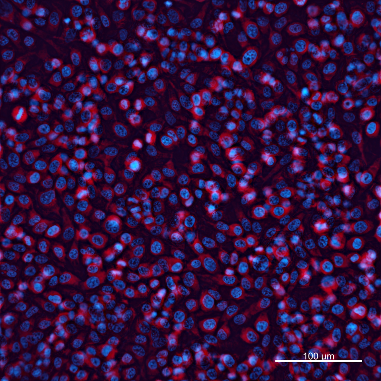 Ankyron CADH4_HUMAN Clone DV40431