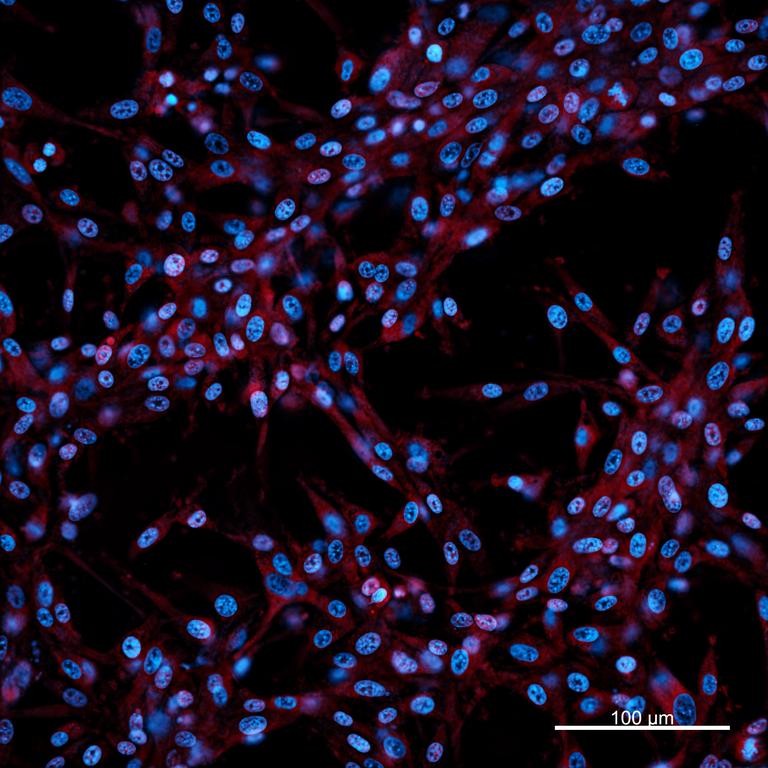 Ankyron CADM1_HUMAN Clone BV40621