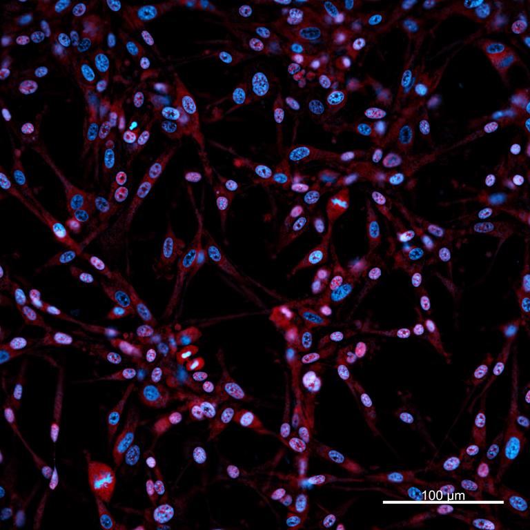 Ankyron CADM1_HUMAN Clone CL40142