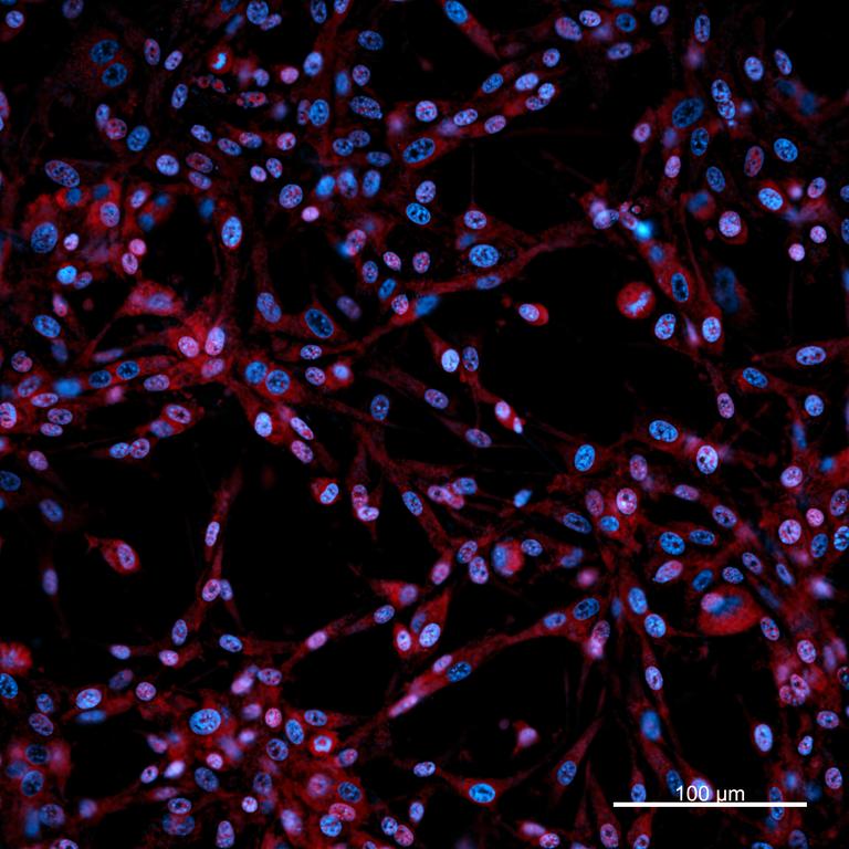 Ankyron CADM1_HUMAN Clone CL40150