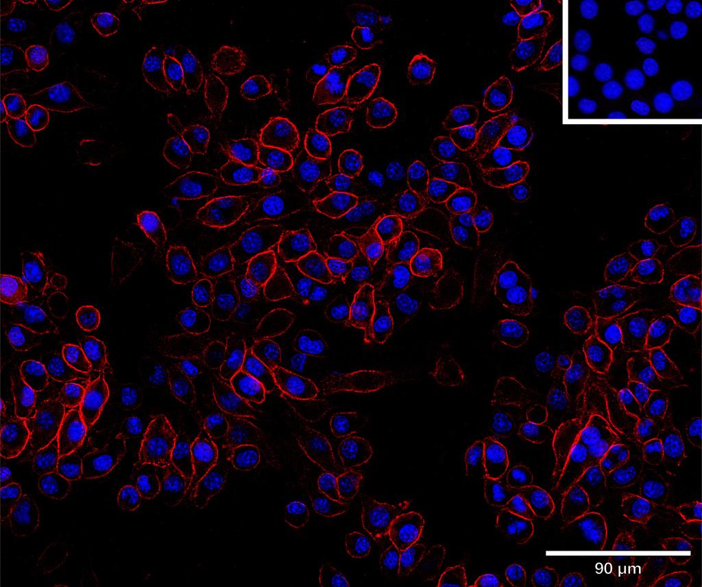 Ankyron CADM1_MOUSE Clone AT40738