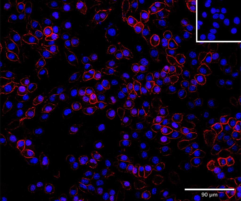 Ankyron CADM1_MOUSE Clone AT40739